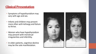 Clinical Presentation
• Symptoms of hypothyroidism may
vary with age and sex.
• Infants and children may present
more often with lethargy and failure
to thrive.
• Women who have hypothyroidism
may present with menstrual
irregularities and infertility.
• In older patients, cognitive decline
may be the sole manifestation.
 