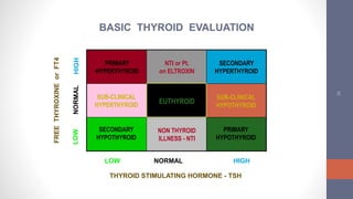32
FREETHYROXINEorFT4
EUTHYROID
SUB-CLINICAL
HYPERTHYROID
NON THYROID
ILLNESS - NTI
NTI or Pt.
on ELTROXIN
SUB-CLINICAL
HYPOTHYROID
SECONDARY
HYPERTHYROID
SECONDARY
HYPOTHYROID
PRIMARY
HYPERTHYROID
PRIMARY
HYPOTHYROID
LOW NORMAL HIGH
THYROID STIMULATING HORMONE - TSH
BASIC THYROID EVALUATION
 