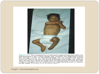 vitrag24 - www.medicalgeek.com
 