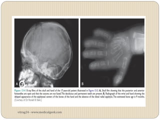 vitrag24 - www.medicalgeek.com
 