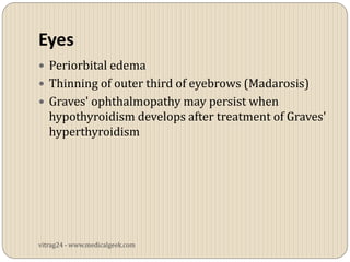 Eyes
 Periorbital edema
 Thinning of outer third of eyebrows (Madarosis)
 Graves' ophthalmopathy may persist when
   hypothyroidism develops after treatment of Graves'
   hyperthyroidism




vitrag24 - www.medicalgeek.com
 