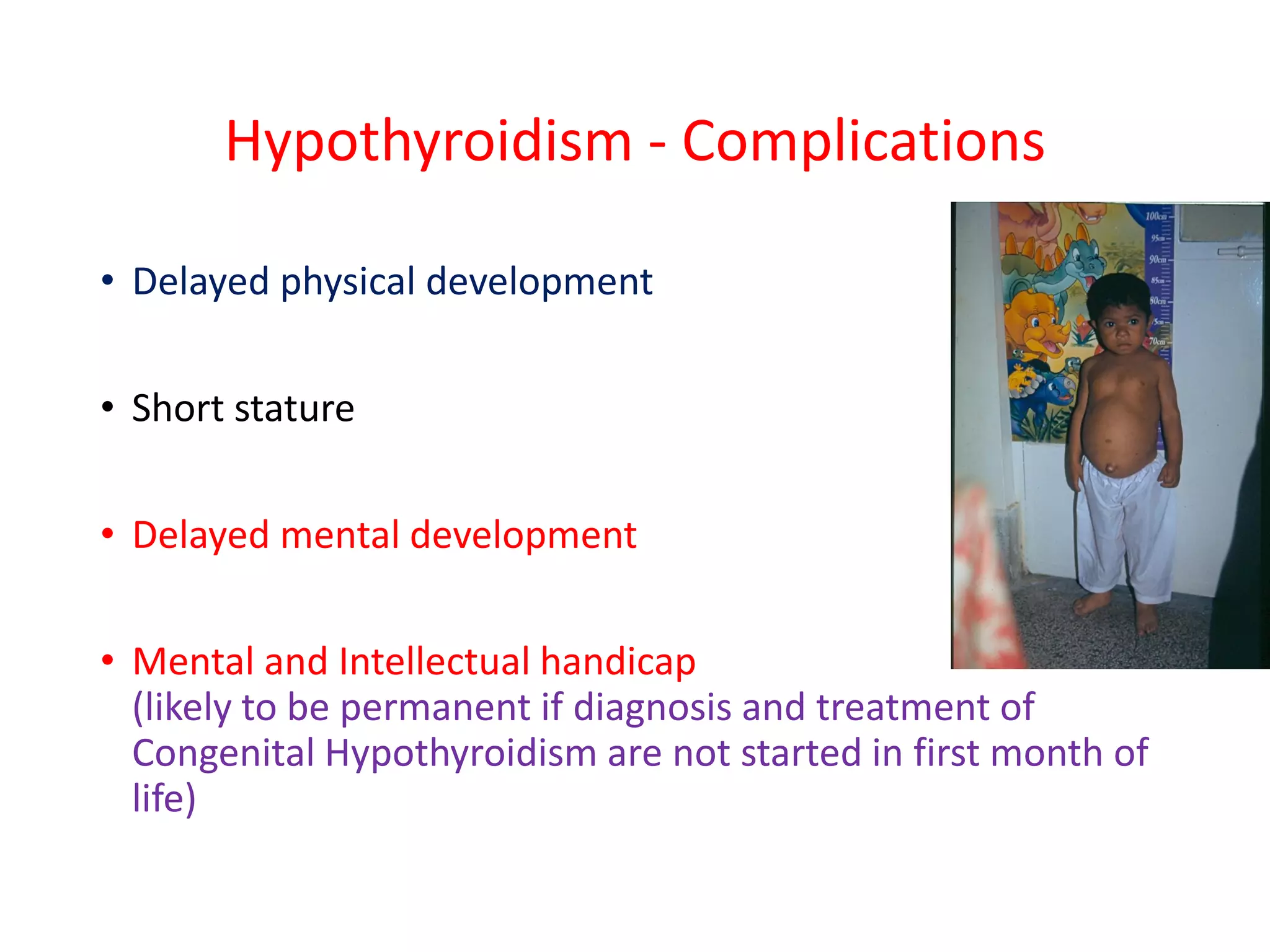 Hypothyroidism in children 2021 | PDF