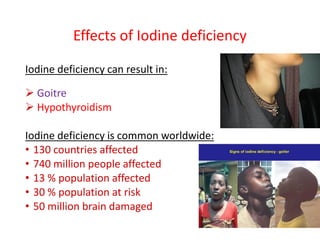 Effects of Iodine deficiency
Iodine deficiency can result in:
 Goitre
 Hypothyroidism
Iodine deficiency is common worldwide:
• 130 countries affected
• 740 million people affected
• 13 % population affected
• 30 % population at risk
• 50 million brain damaged
 