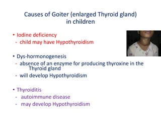 Causes of Goiter (enlarged Thyroid gland)
in children
• Iodine deficiency
- child may have Hypothyroidism
• Dys-hormonogenesis
- absence of an enzyme for producing thyroxine in the
Thyroid gland
- will develop Hypothyroidism
• Thyroiditis
- autoimmune disease
- may develop Hypothyroidism
 