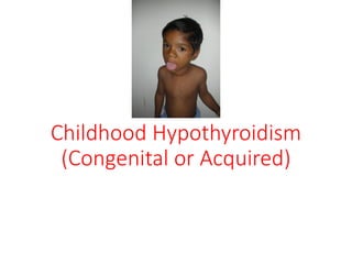 Childhood Hypothyroidism
(Congenital or Acquired)
 