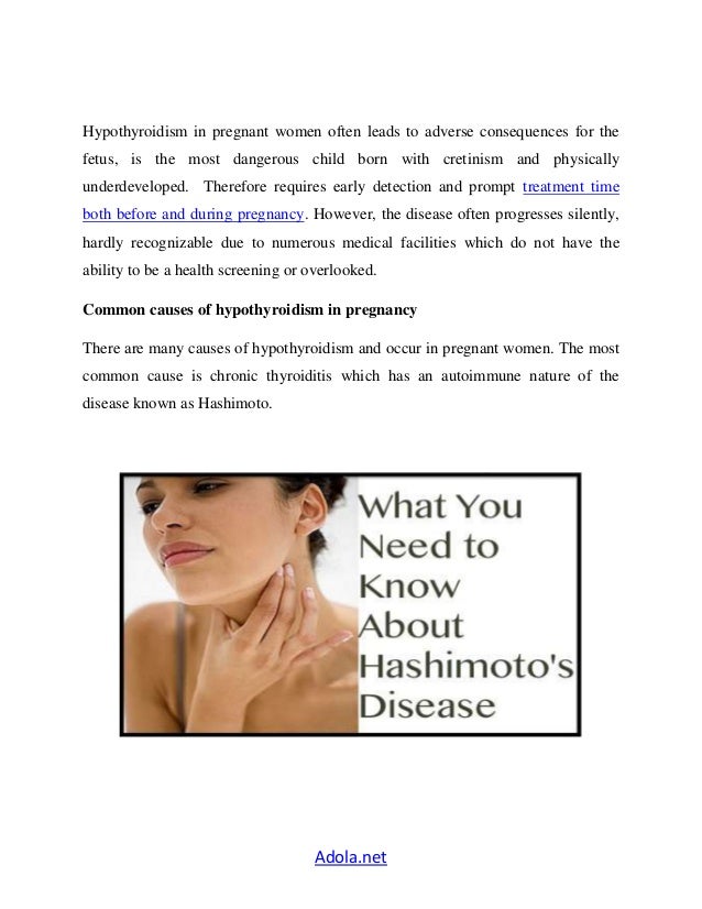 Hypothyroidism in pregnant women and unpredictable consequences