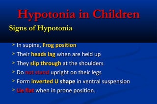 Hypotonia in ChildrenHypotonia in Children
 In supine,In supine, FrogFrog positionposition
 TheirTheir heads lagheads lag when are held upwhen are held up
 TheyThey slip throughslip through at the shouldersat the shoulders
 DoDo not standnot stand upright on their legsupright on their legs
 FormForm inverted Uinverted U shapeshape in ventral suspensionin ventral suspension
 Lie flatLie flat when in prone positionwhen in prone position..
Signs of HypotoniaSigns of Hypotonia
 