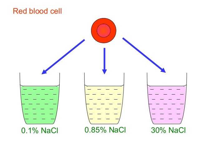 chapter 3 2 hypotonic hypertonic and isotonic solutions hypertonic cell