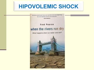 HIPOVOLEMIC SHOCK
 
