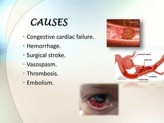 • Congestive cardiac failure.
• Hemorrhage.
• Surgical stroke.
• Vasospasm.
• Thrombosis.
• Embolism.
 