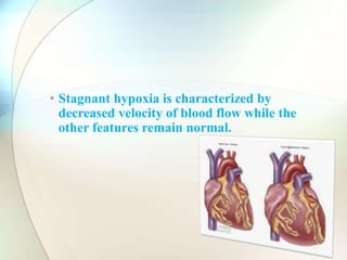 • Stagnant hypoxia is characterized by
decreased velocity of blood flow while the
other features remain normal.
 