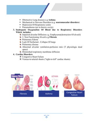  Obstructive Lung diseases e.g Asthma
 Mechanical or Nervous Disorders (e.g. neuromuscular disorders)
 Depression Of Respiratory centre
 Pneumothorax (air in thorcic cavity)
3. Inadequate Oxygenation Of Blood due to Respiratory Disorders
Which includes:
Impaired alveolar Diffusion e.g. Emphysema(destruction Of alvoeli)
2. Non Functioning Alveoli e.g Fibrosis
Pulmonary Edema
Lack Of Surfactant . Collapse Of lungs
Pulmonary disease
Abnormal alveolar ventilation-perfusion ratio (T physiologic dead
space)
Diminished respiratory membmne diffusion
4. Cardiac Disorders
 Congestive Heart Failure
 Venous-to-arterial shunts ("right-to-left" cardiac shunts)
Fibrosis Asthma
Congestive Heart
Failure
 