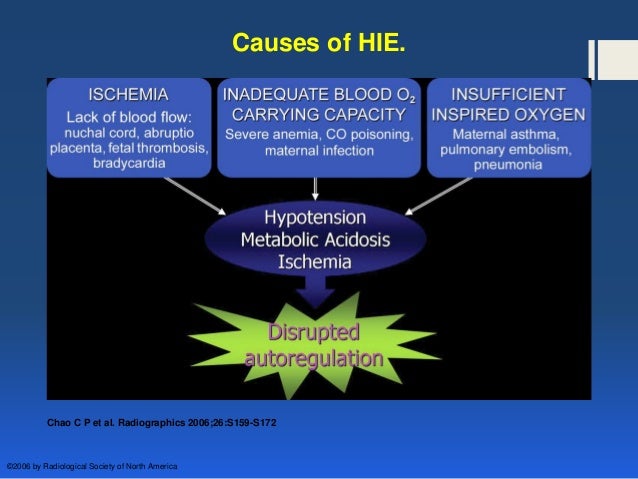 hypoxic ischemic encephalopathy