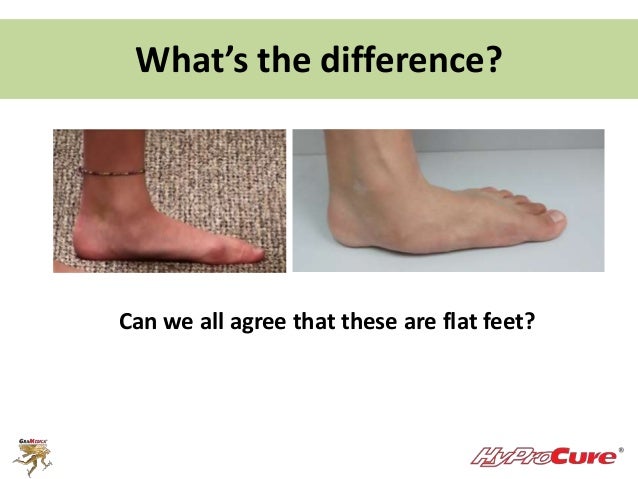 flat footed rome fontanacountryinn com flat footed