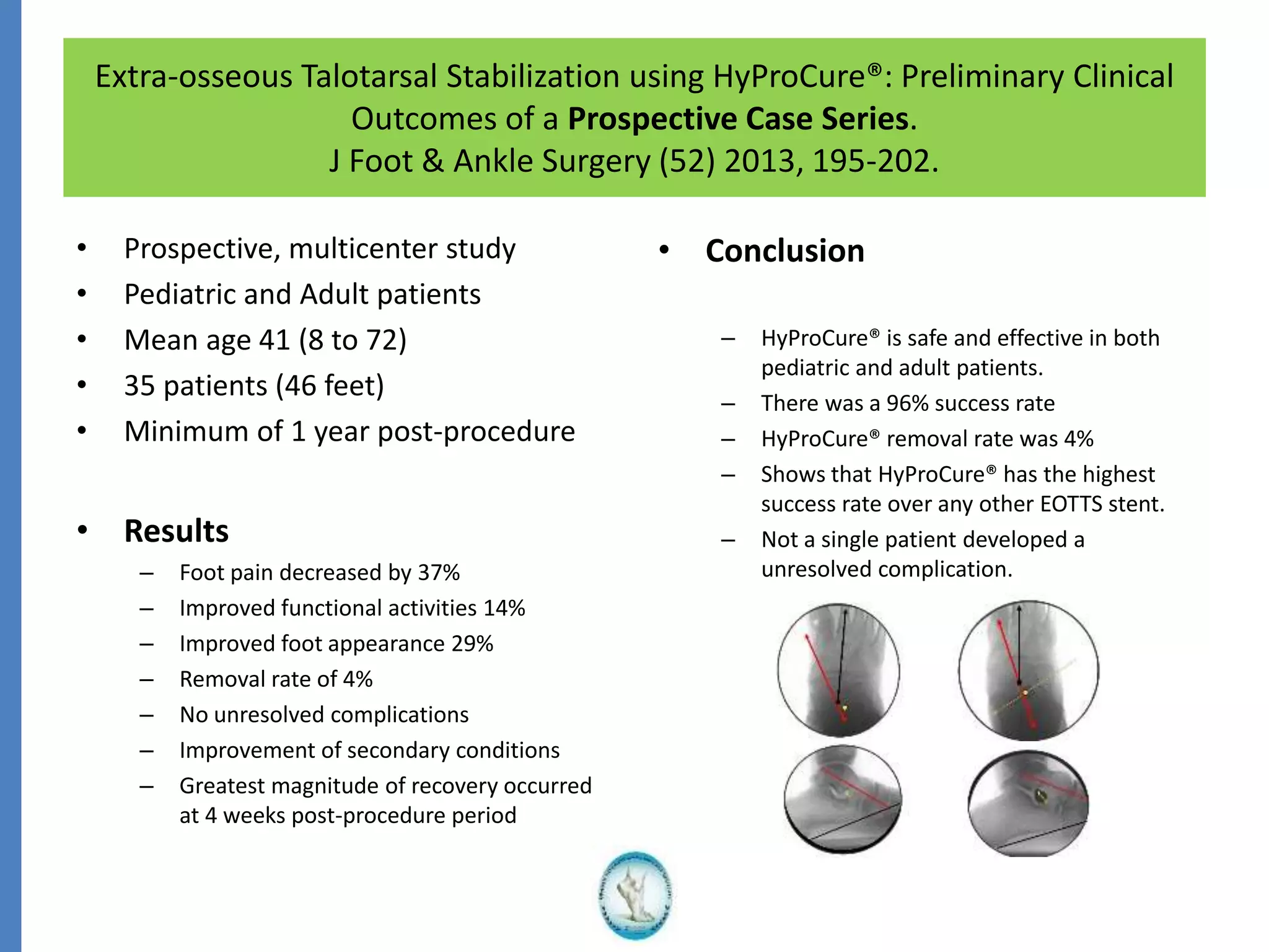 Extra-osseous Talotarsal Stabilization using HyProCure®: Preliminary Clinical
Outcomes of a Prospective Case Series.
J Foot & Ankle Surgery (52) 2013, 195-202.
• Prospective, multicenter study
• Pediatric and Adult patients
• Mean age 41 (8 to 72)
• 35 patients (46 feet)
• Minimum of 1 year post-procedure
• Results
– Foot pain decreased by 37%
– Improved functional activities 14%
– Improved foot appearance 29%
– Removal rate of 4%
– No unresolved complications
– Improvement of secondary conditions
– Greatest magnitude of recovery occurred
at 4 weeks post-procedure period
• Conclusion
– HyProCure® is safe and effective in both
pediatric and adult patients.
– There was a 96% success rate
– HyProCure® removal rate was 4%
– Shows that HyProCure® has the highest
success rate over any other EOTTS stent.
– Not a single patient developed a
unresolved complication.
 