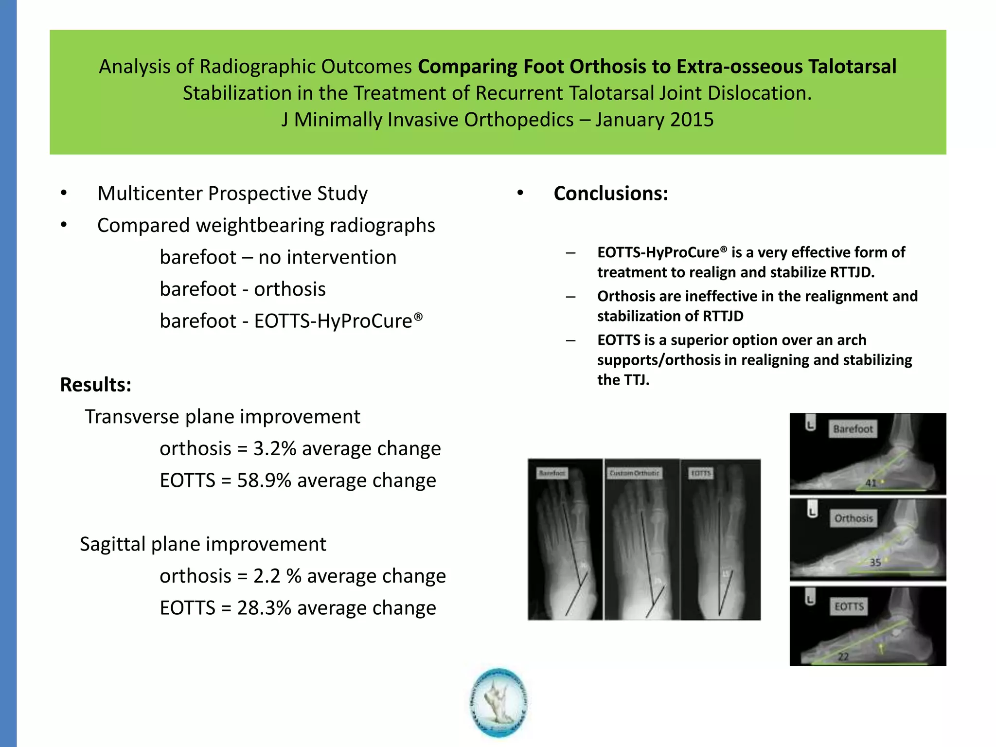 Analysis of Radiographic Outcomes Comparing Foot Orthosis to Extra-osseous Talotarsal
Stabilization in the Treatment of Recurrent Talotarsal Joint Dislocation.
J Minimally Invasive Orthopedics – January 2015
• Multicenter Prospective Study
• Compared weightbearing radiographs
barefoot – no intervention
barefoot - orthosis
barefoot - EOTTS-HyProCure®
Results:
Transverse plane improvement
orthosis = 3.2% average change
EOTTS = 58.9% average change
Sagittal plane improvement
orthosis = 2.2 % average change
EOTTS = 28.3% average change
• Conclusions:
– EOTTS-HyProCure® is a very effective form of
treatment to realign and stabilize RTTJD.
– Orthosis are ineffective in the realignment and
stabilization of RTTJD
– EOTTS is a superior option over an arch
supports/orthosis in realigning and stabilizing
the TTJ.
 