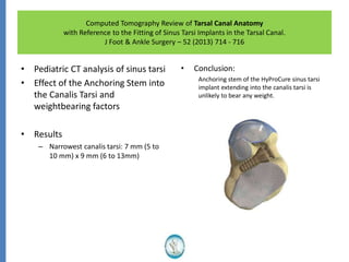 Computed Tomography Review of Tarsal Canal Anatomy
with Reference to the Fitting of Sinus Tarsi Implants in the Tarsal Canal.
J Foot & Ankle Surgery – 52 (2013) 714 - 716
• Pediatric CT analysis of sinus tarsi
• Effect of the Anchoring Stem into
the Canalis Tarsi and
weightbearing factors
• Results
– Narrowest canalis tarsi: 7 mm (5 to
10 mm) x 9 mm (6 to 13mm)
• Conclusion:
Anchoring stem of the HyProCure sinus tarsi
implant extending into the canalis tarsi is
unlikely to bear any weight.
 
