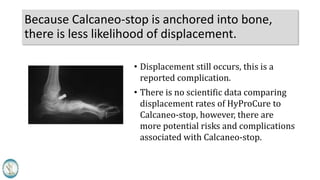 Because Calcaneo-stop is anchored into bone,
there is less likelihood of displacement.
• Displacement still occurs, this is a
reported complication.
• There is no scientific data comparing
displacement rates of HyProCure to
Calcaneo-stop, however, there are
more potential risks and complications
associated with Calcaneo-stop.
 