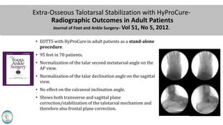 Extra-Osseous Talotarsal Stabilization with HyProCure-
Radiographic Outcomes in Adult Patients
Journal of Foot and Ankle Surgery– Vol 51, No 5, 2012.
• EOTTS with HyProCure in adult patients as a stand-alone
procedure.
• 95 feet in 70 patients.
• Normalization of the talar second metatarsal angle on the
AP view.
• Normalization of the talar declination angle on the sagittal
view.
• No effect on the calcaneal inclination angle.
• Shows both transverse and sagittal plane
correction/stabilization of the talotarsal mechanism and
therefore also frontal plane correction.
 