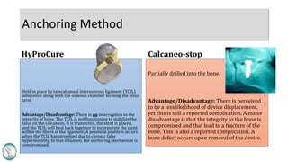Held in place by talocalcaneal interosseous ligament (TCIL)
adherence along with the osseous chamber forming the sinus
tarsi.
Advantage/Disadvantage: There is no interruption to the
integrity of bone. The TCIL is not functioning to stabilize the
talus on the calcaneus. It is transected, the stent is placed,
and the TCIL will heal back together to incorporate the stent
within the fibers of the ligament. A potential problem occurs
when the TCIL has atrophied due to chronic talar
hypermobility. In that situation, the anchoring mechanism is
compromised.
Anchoring Method
Partially drilled into the bone.
Advantage/Disadvantage: There is perceived
to be a less likelihood of device displacement,
yet this is still a reported complication. A major
disadvantage is that the integrity to the bone is
compromised and that lead to a fracture of the
bone. This is also a reported complication. A
bone defect occurs upon removal of the device.
HyProCure Calcaneo-stop
 