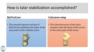 How is talar stabilization accomplished?
• The smooth tapered section of
HyProCure stabilizes the talus at the
axis point of the subtalar joint.
• The lateral process of the talus
smashes into the head of the screw
in the outer part of the sinus.
HyProCure Calcaneo-stop
 