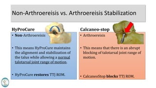 Non-Arthroereisis vs. Arthroereisis Stabilization
• Non-Arthroereisis
• This means HyProCure maintains
the alignment and stabilization of
the talus while allowing a normal
talotarsal joint range of motion.
• HyProCure restores TTJ ROM.
• Arthroereisis
• This means that there is an abrupt
blocking of talotarsal joint range of
motion.
• Calcaneo-stop blocks TTJ ROM.
HyProCure Calcaneo-stop
 