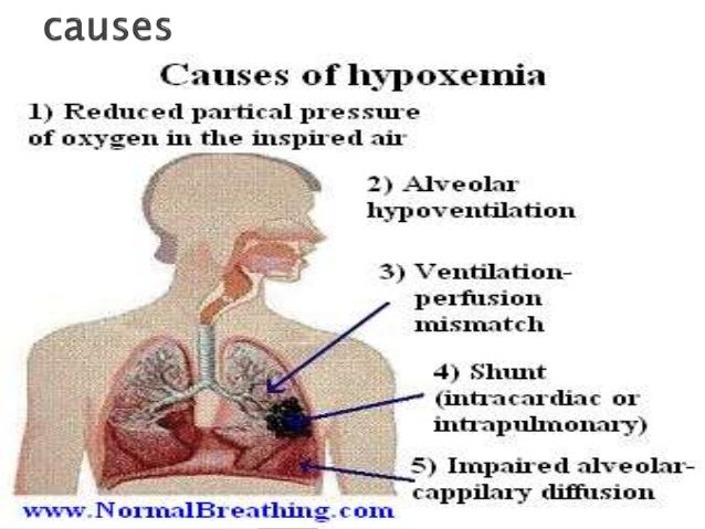 hypoxemia