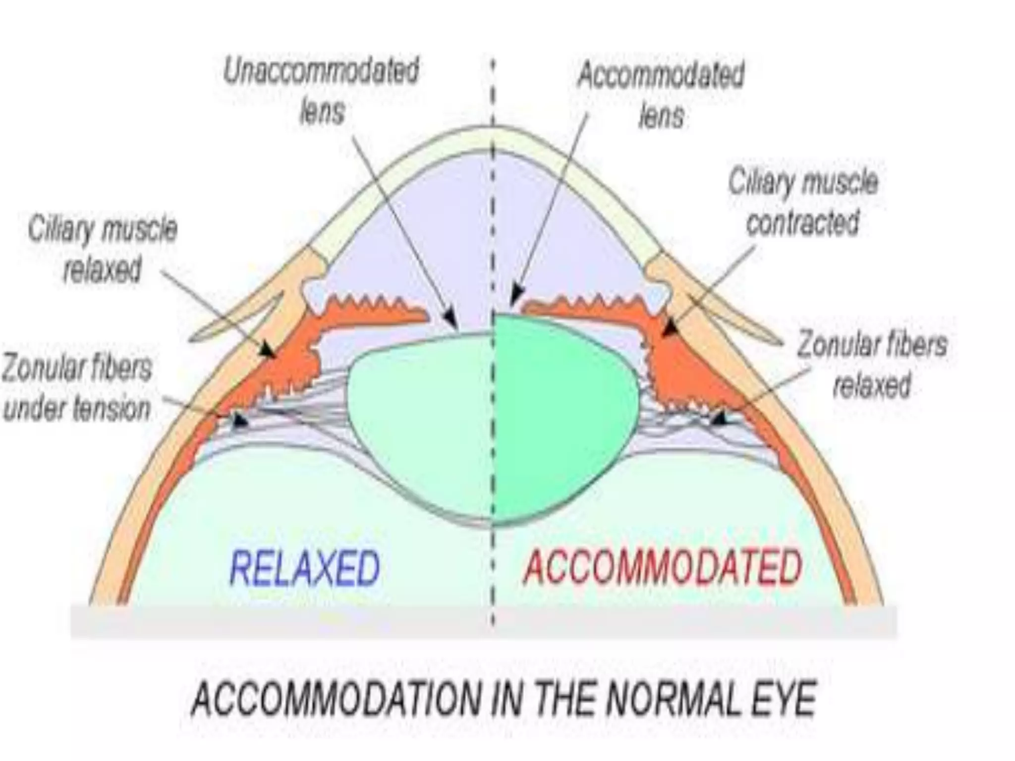Ophthalmology High yield review