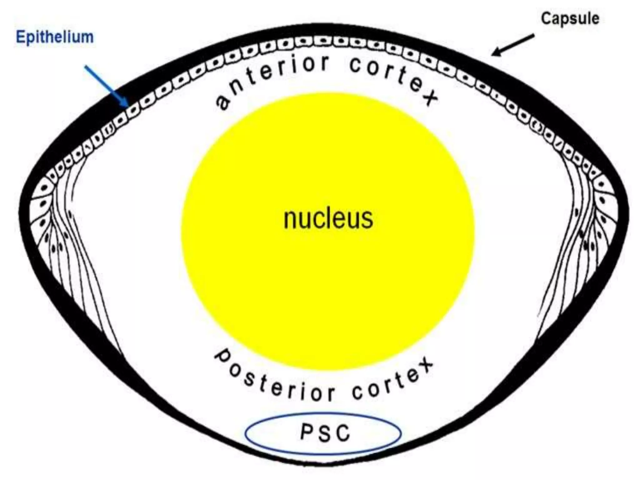 Ophthalmology High yield review