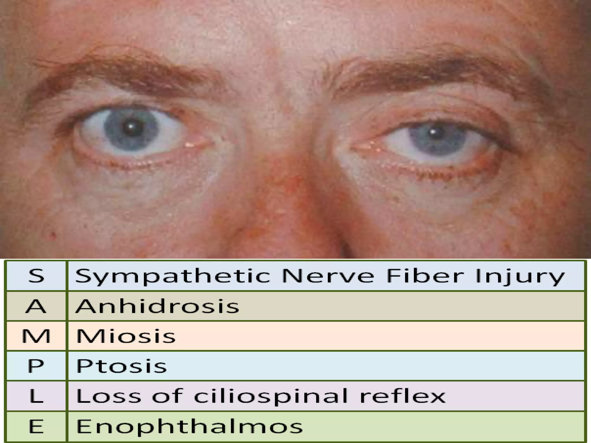 Ophthalmology High yield review