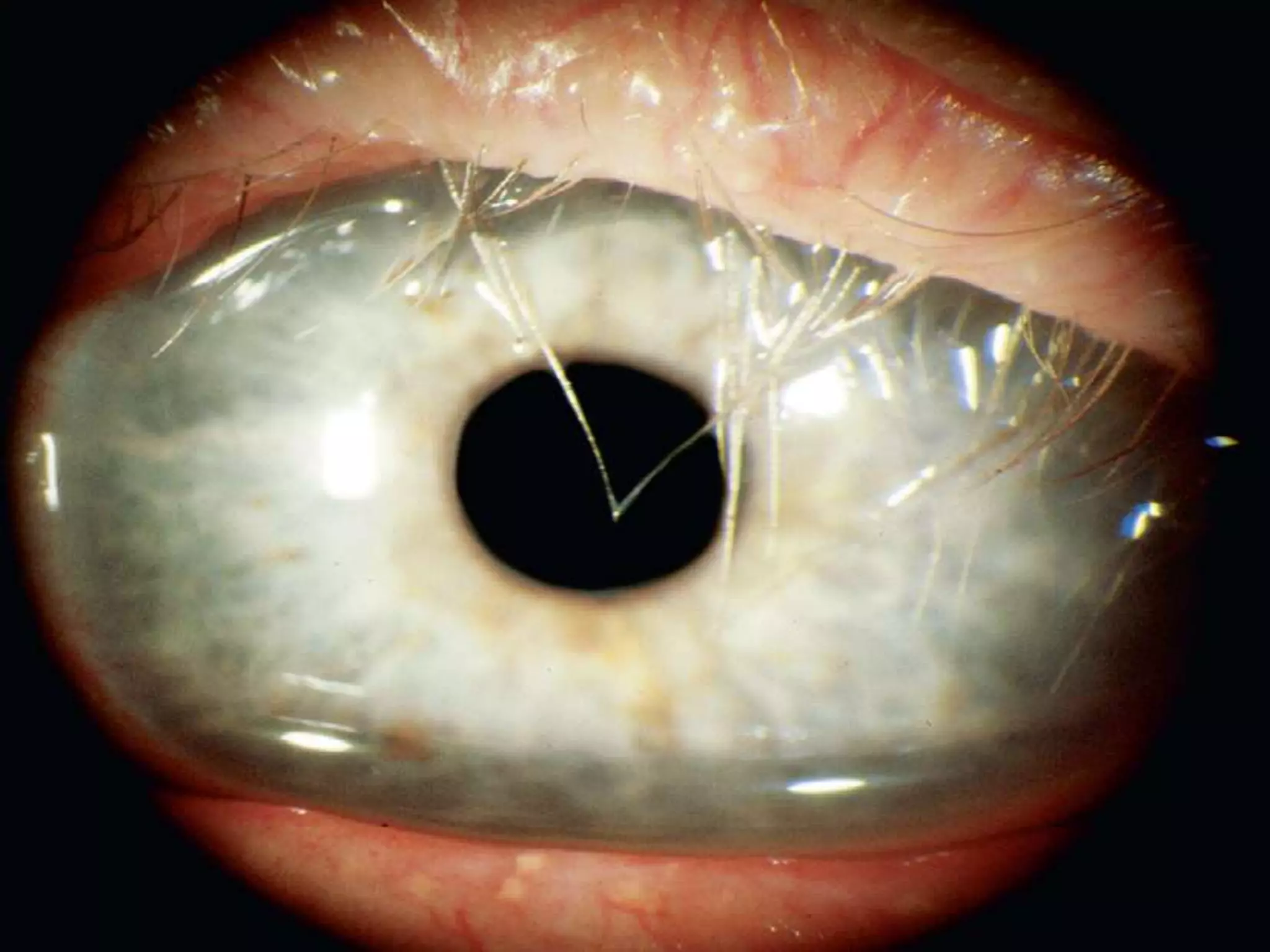 Ophthalmology High yield review