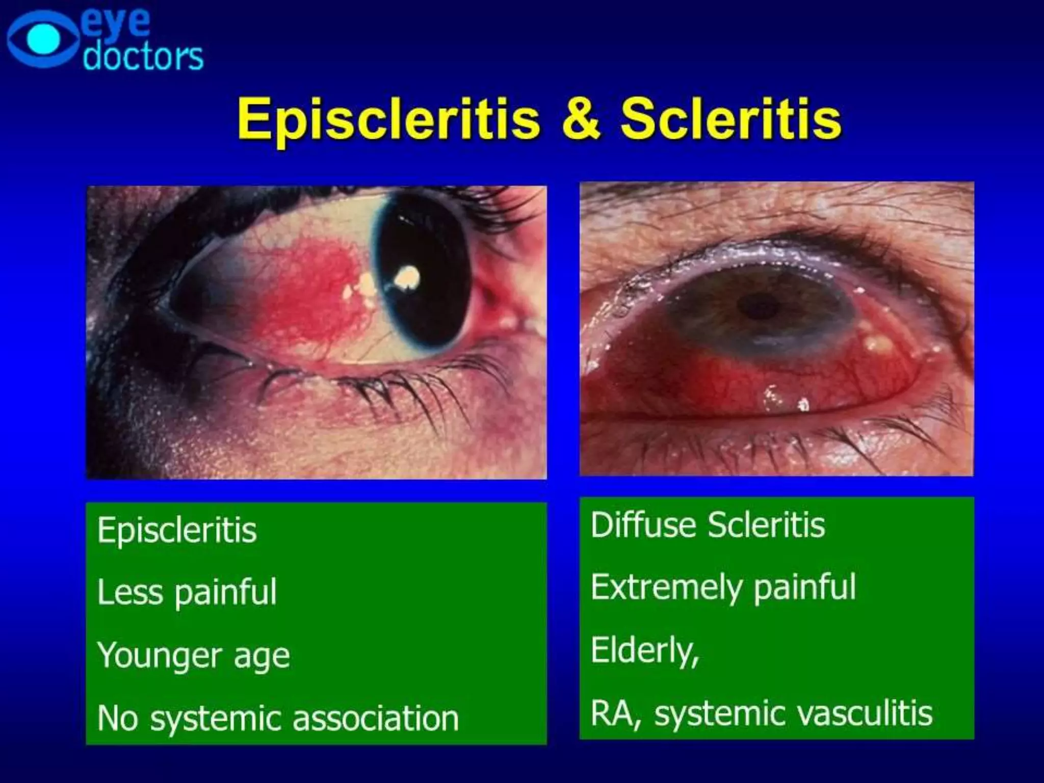Ophthalmology High yield review