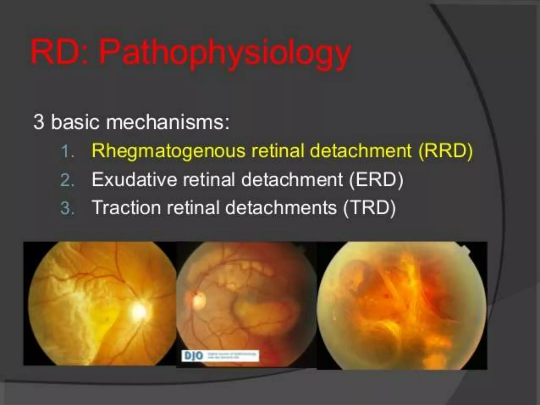 Ophthalmology High yield review