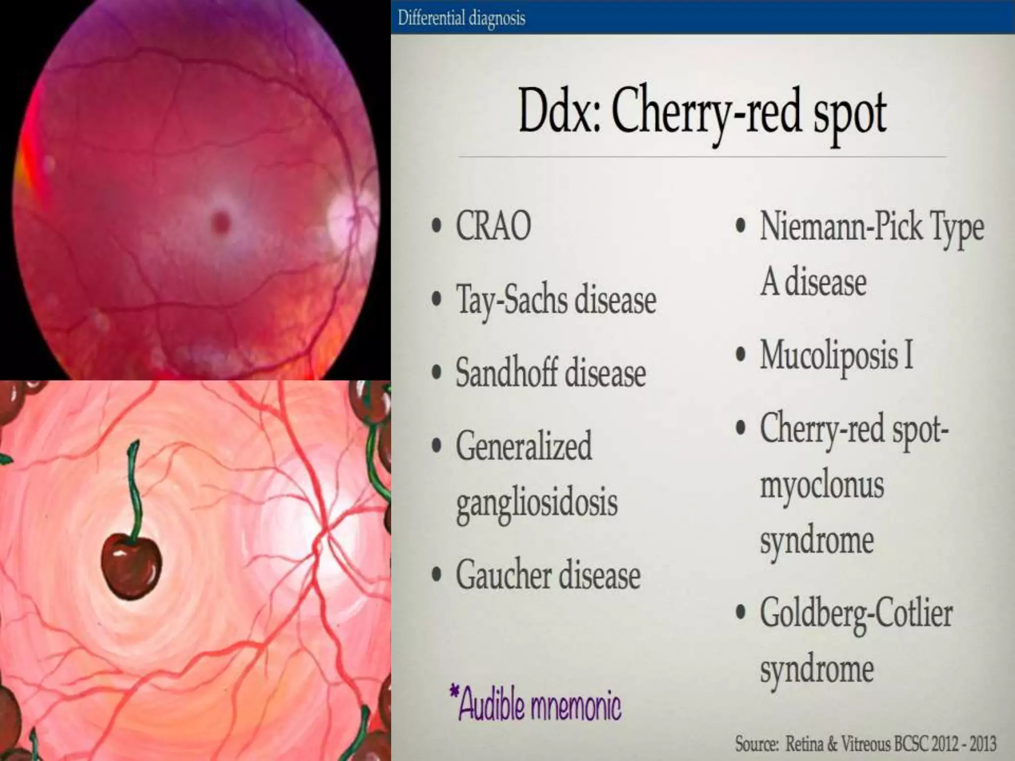 Ophthalmology High yield review