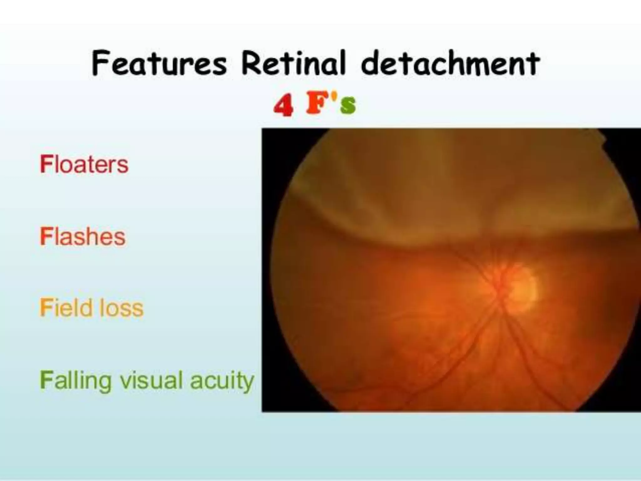 Ophthalmology High yield review