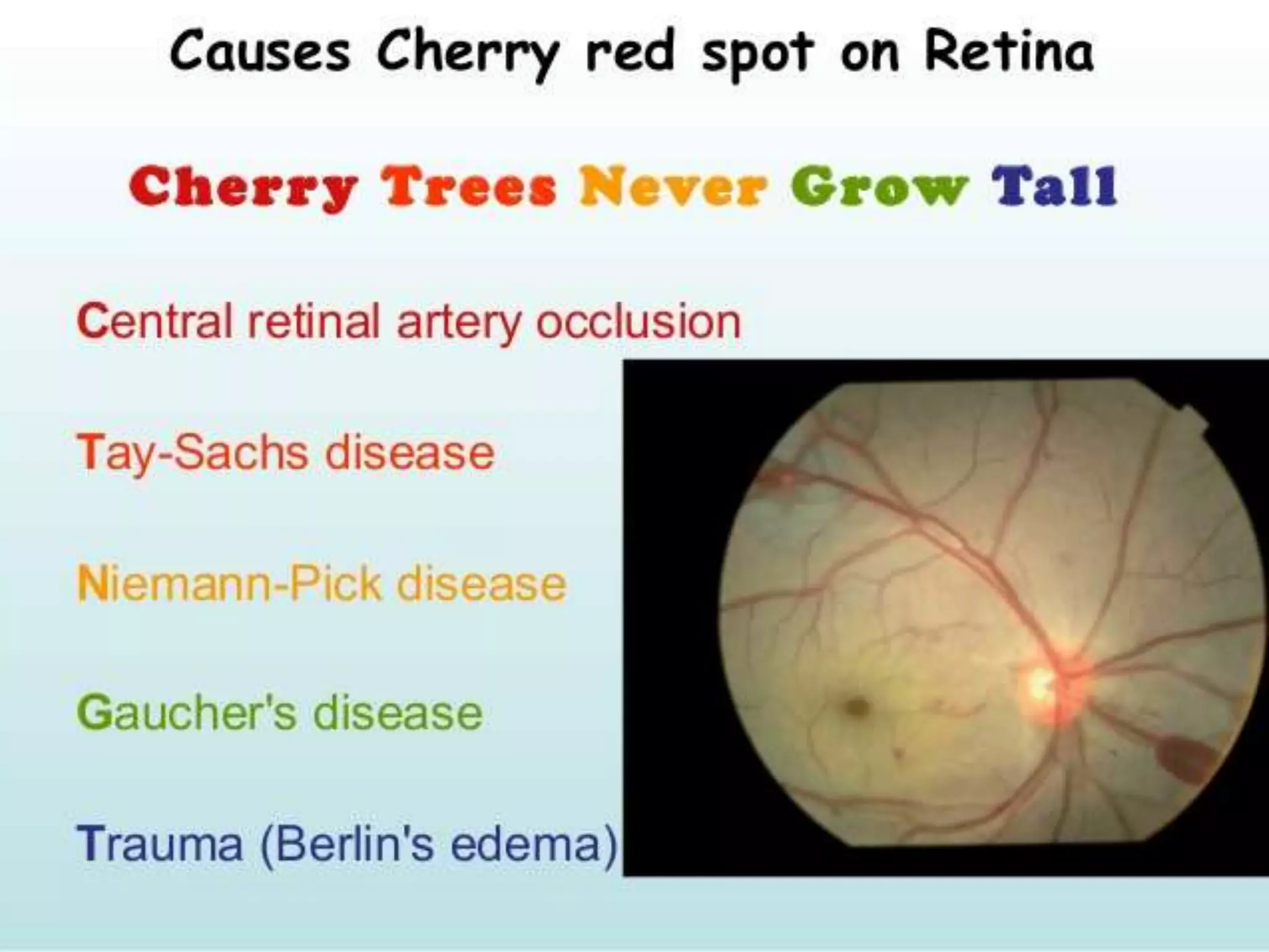 Ophthalmology High yield review