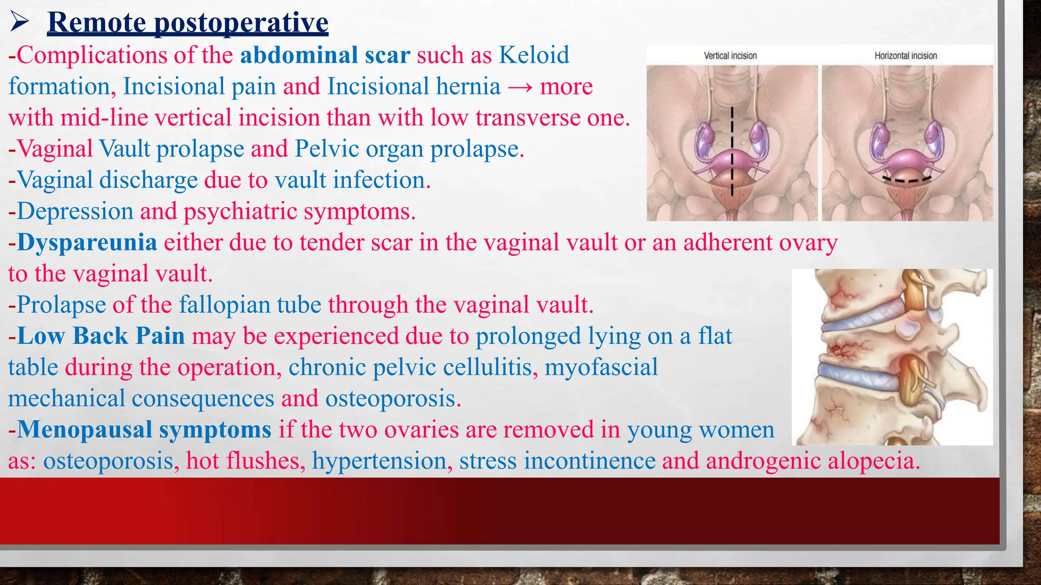 Hysterectomy Removal Of Uterus Body pptx Hysterectomy removal of uterus body pptx
