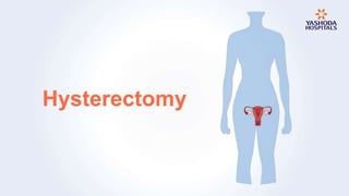 Hysterectomy
 