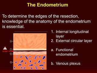 1. Internal longitudinal
layer
2. External circular layer
a. Functional
endometrium
b. Venous plexus
The Endometrium
To determine the edges of the resection,
knowledge of the anatomy of the endometrium
is essential.
 
