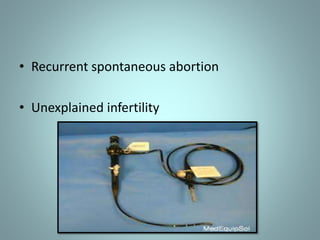 • Recurrent spontaneous abortion 
• Unexplained infertility 
 