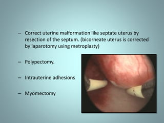 – Correct uterine malformation like septate uterus by 
resection of the septum. (bicorneate uterus is corrected 
by laparotomy using metroplasty) 
– Polypectomy. 
– Intrauterine adhesions 
– Myomectomy 
 