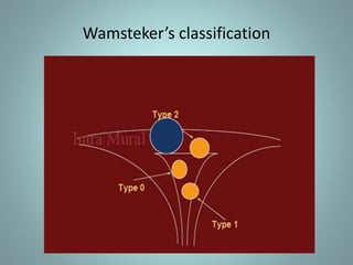 Wamsteker’s classification 
 