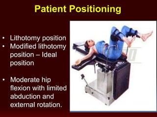 Patient Positioning
• Lithotomy position
• Modified lithotomy
position – Ideal
position
• Moderate hip
flexion with limited
abduction and
external rotation.
 