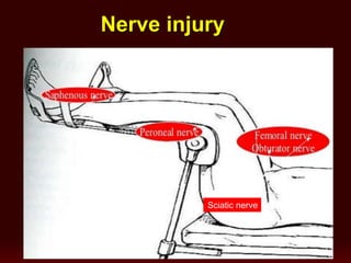 Nerve injury
Sciatic nerve
 