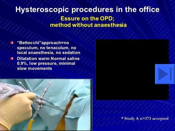 Hysteroscopy 0
