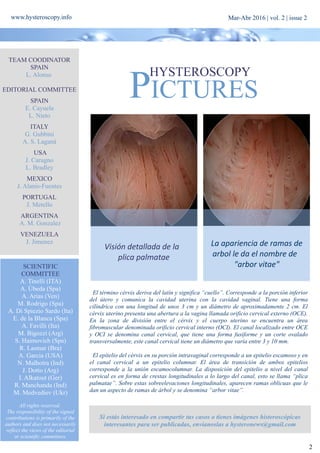 Hysteroscopy Newsletter Vol 2 Issue 2 Spanish Pdf