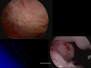 Aboubakr ElnasharAboubakr Elnashar  