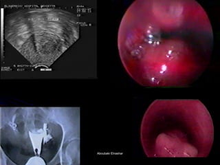 15 
36 
38 
Aboubakr ElnasharAboubakr Elnashar  