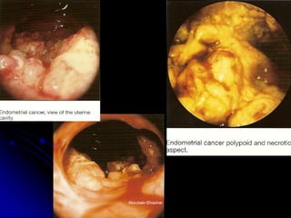 ) 
Aboubakr ElnasharAboubakr Elnashar  