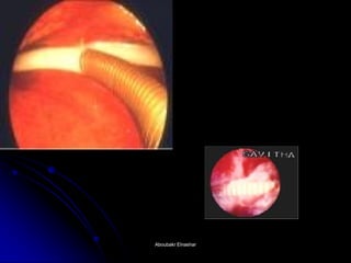 Aboubakr ElnasharAboubakr Elnashar  